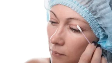 Understanding laser eyelid removal: A comprehensive guide