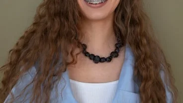 Understanding plastic braces: benefits, options, and care